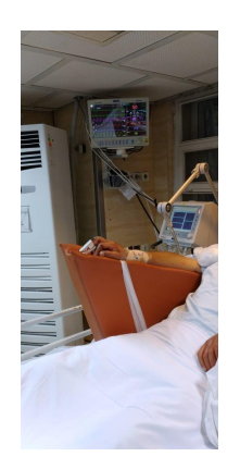 بالابرنده دست بیمار