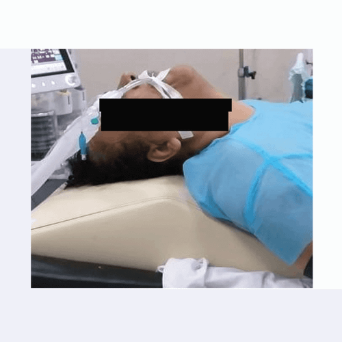 رمپ عمل تیروئید