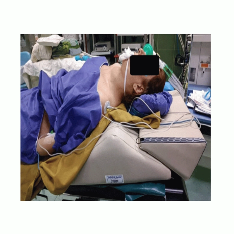 رمپ عمل تیروئید